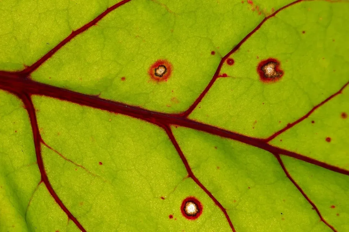 Die 4 häufigsten Gefäßzugänge für Dialyse
